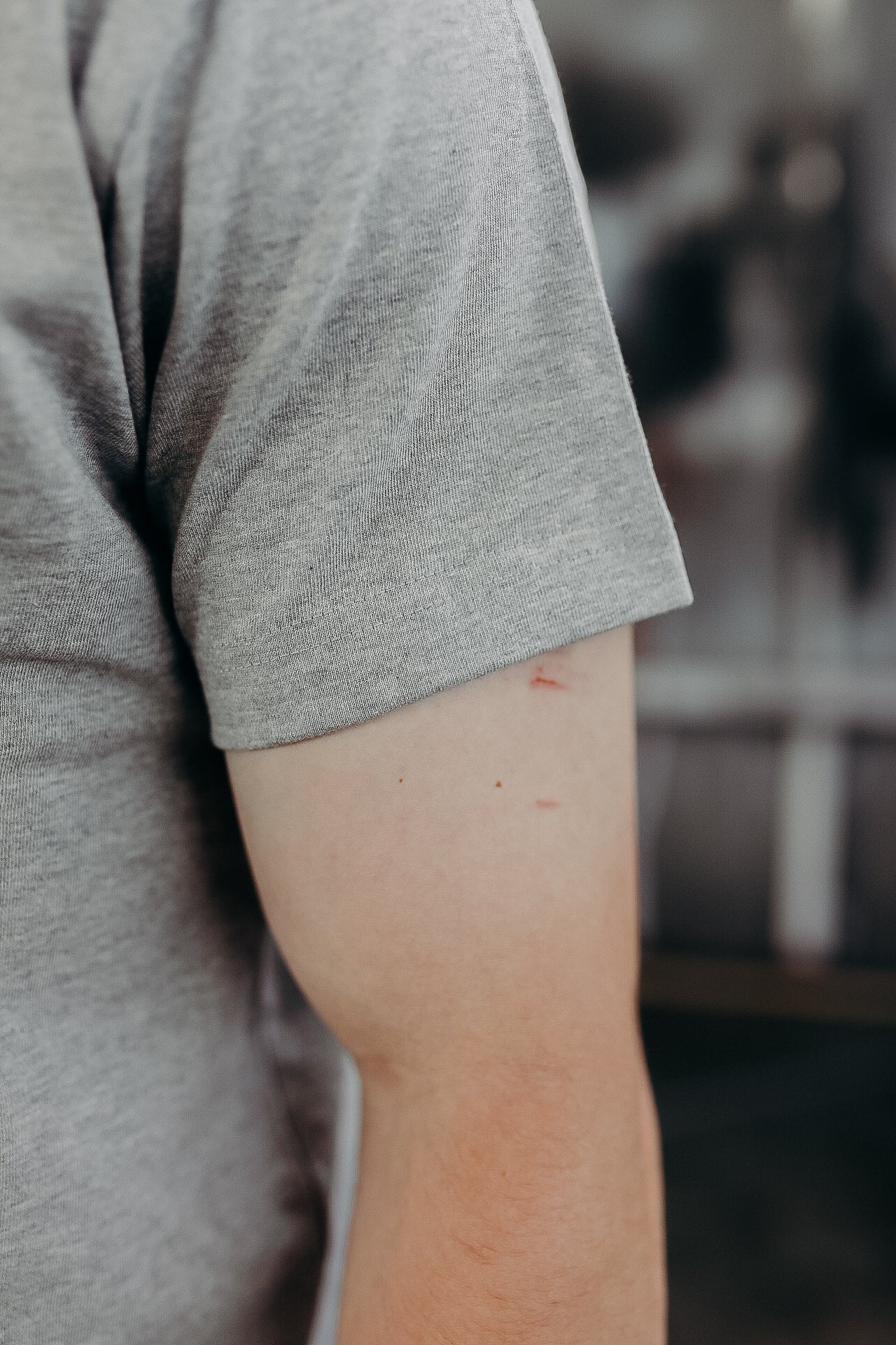 Close-up of a person's upper arm wearing a grey short sleeve shirt with small scratches on the skin